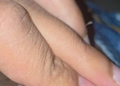 Closeup