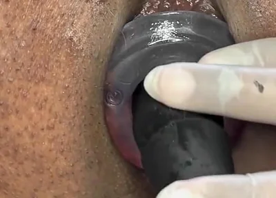 Ass Gape