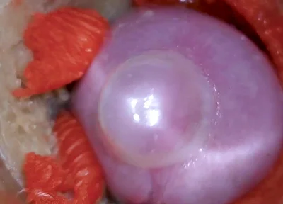 The Camera Inside the Deep Pussy Records a Huge Ejaculation with a Stuck Condom 4K