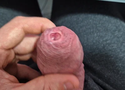 Uncut Tight Phimosis Cock Precum Tease for Foreskin Lovers with Cumshot