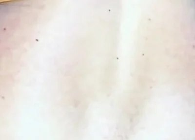 Extreme Anus Gape