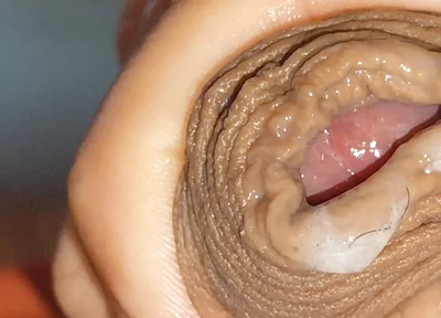 Urethral Fluid in Large Quantities Makes It Slippery.
