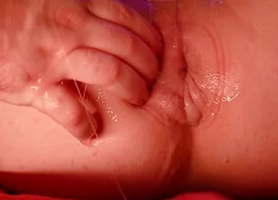 Rose Bud In Fisting A Pumped Donut