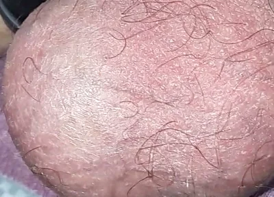 My Balls in POV
