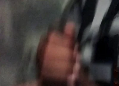 My Hand Exploded When Exposed to Masturbation