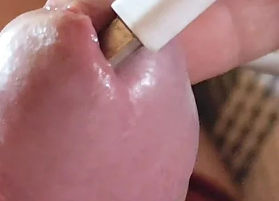 Applying Electric Shocks Inside the Glans.