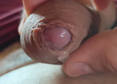 Close-up of Glans Ejaculating Intensely Before Cumming.