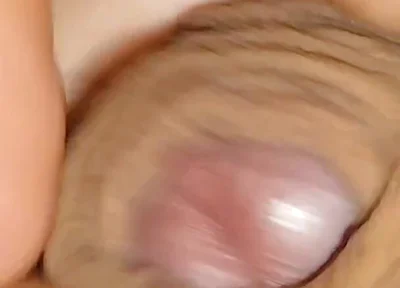 The World's Largest Foreskin Opening and Closing.