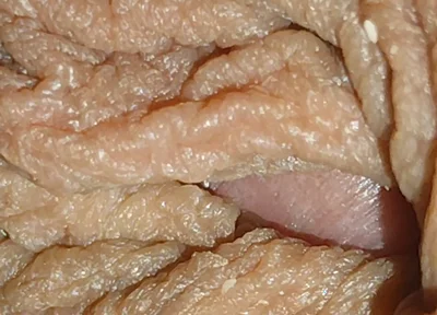 The World's Largest Foreskin Opening and Closing.