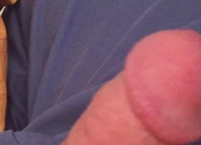 Surprise Dick