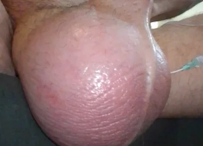 My Plump Juicy Watermelon Getting a Feeding