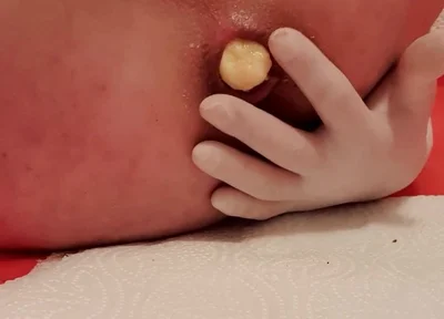 Timmyboy92's Ass Turned Banana Crusher