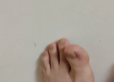 11-26-2025 Cute Little Toes