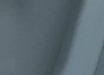 Homemade Method for Freezing the Penis.