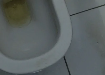 Homemade Method for Freezing the Penis