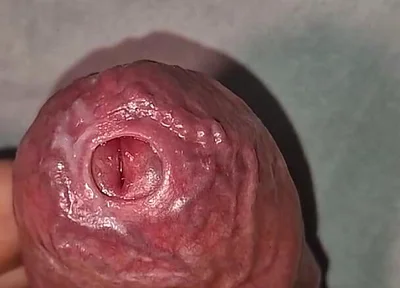 Close up on Phimosis Large Cock, so Hot!