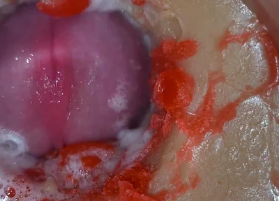 Insemination - Internal Camera Captures Deep Male Ejaculation