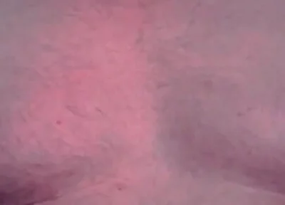 Brust Raus Nippel