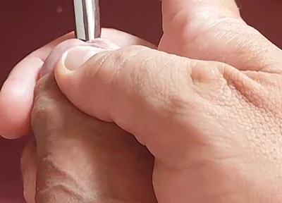 Sounding Strong the Foreskin Between the Trembling Glans.