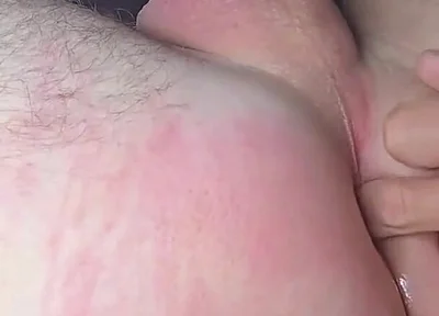 Amateur Anal Stretch