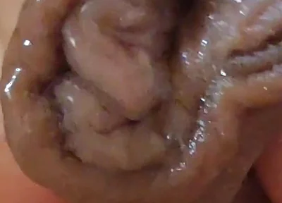 Large Foreskin and Balls in Striking Close-up.